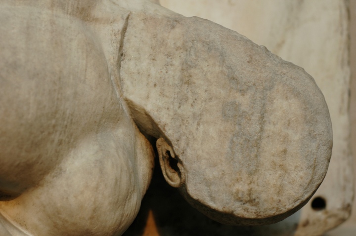 Face erased