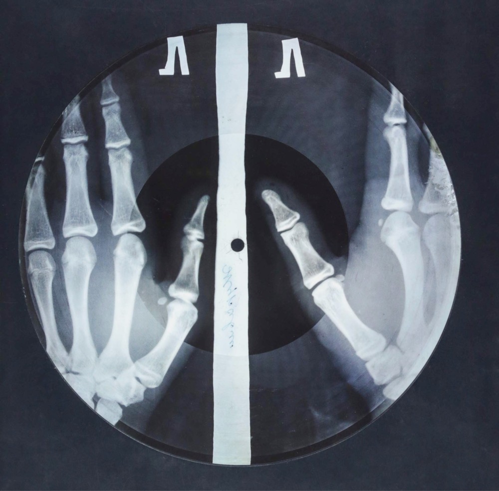 a Soviet record made from a used x-ray film