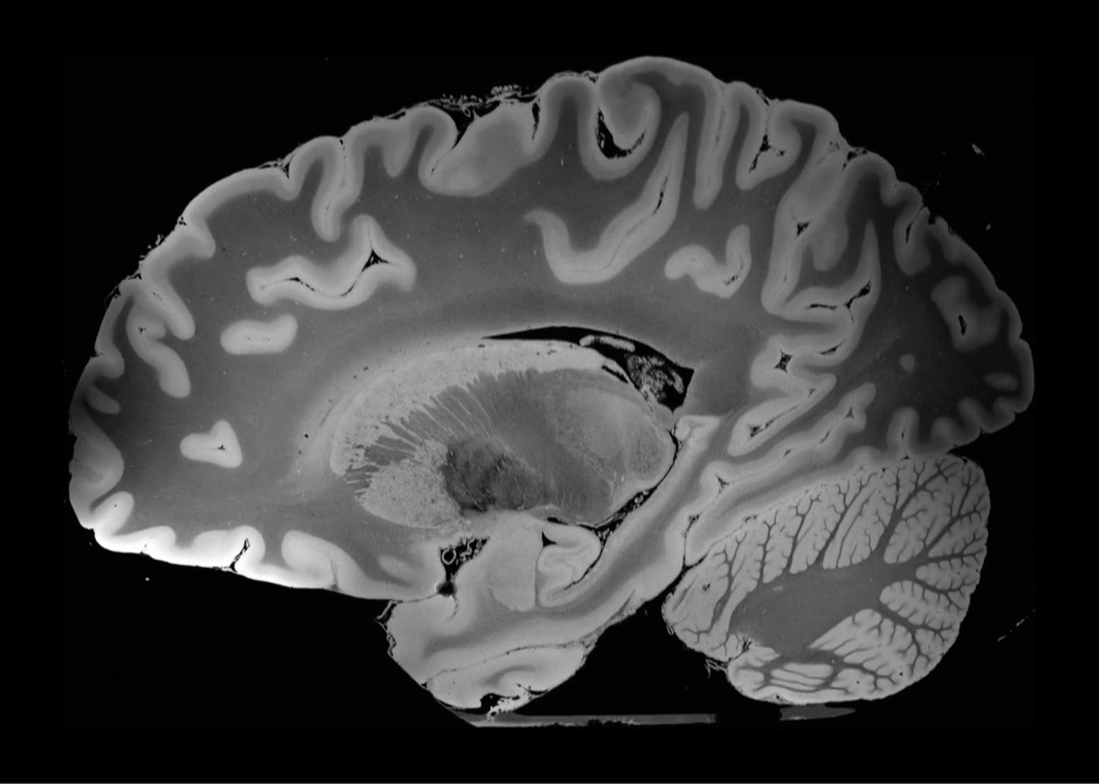 Brain High Res MRI