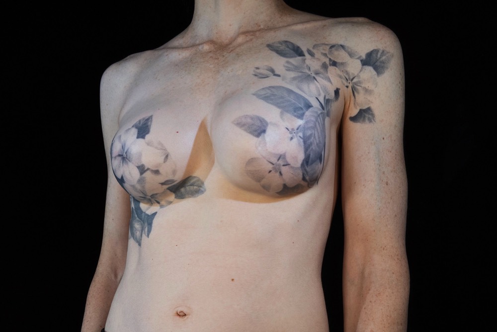 Postmastectomy Tattoos